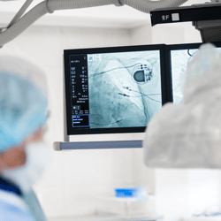 10.9 surgeon observes on x-ray monitors, an implanted pacemaker